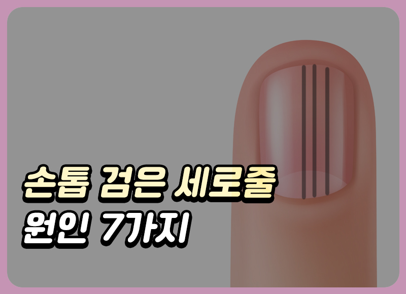 손톱 검은 세로줄 원인 9가지, 당뇨일까? 암일까?