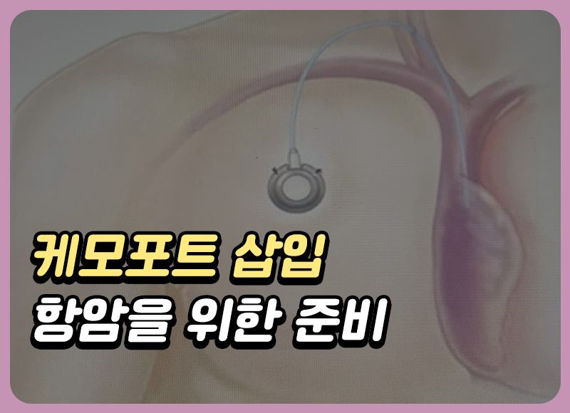 케모포트 삽입술 유방암치료