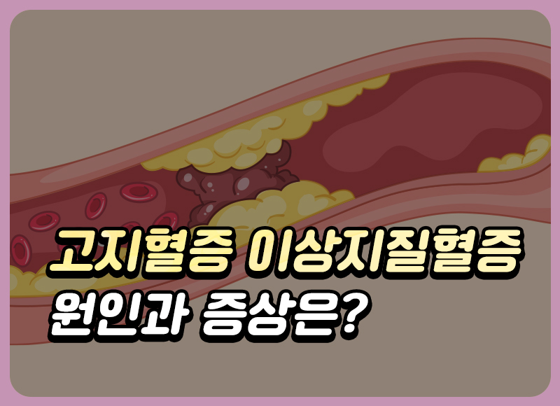 고지혈증