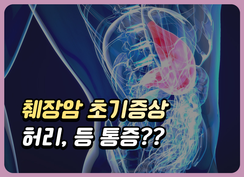 췌장암 초기증상 허리, 등 통증 원인 자가진단